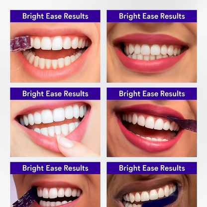 BrightEase™